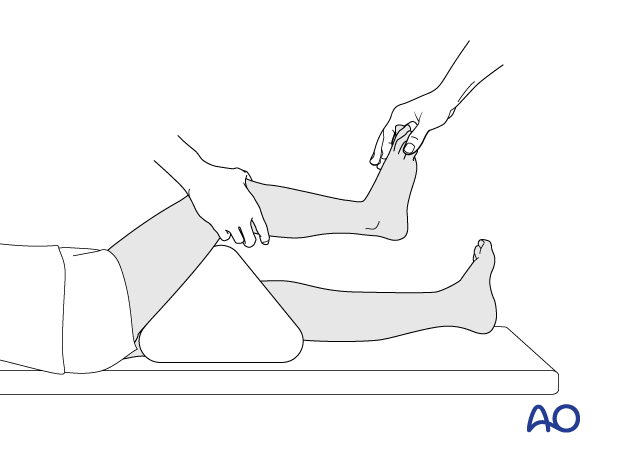 Patient and leg positioning for application of a short leg cast