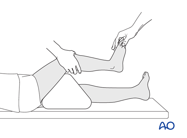 Patient and leg positioning for application of a short leg cast