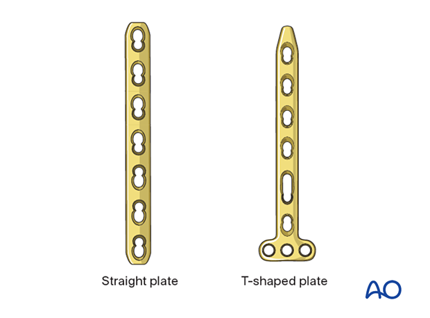 Plate types for fixation of distal tibial fractures