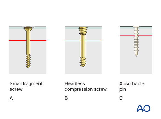 Small fragment screwm headless compression screw, and absorbable pin