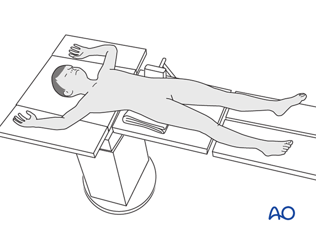 Pediatric patient placed supine on a radiolucent table