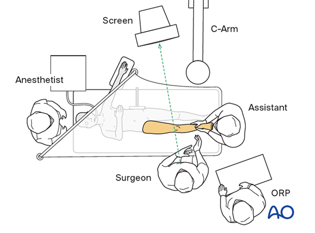OR set-up for operation of the distal tibia and fibula of a pediatric patient in supine position