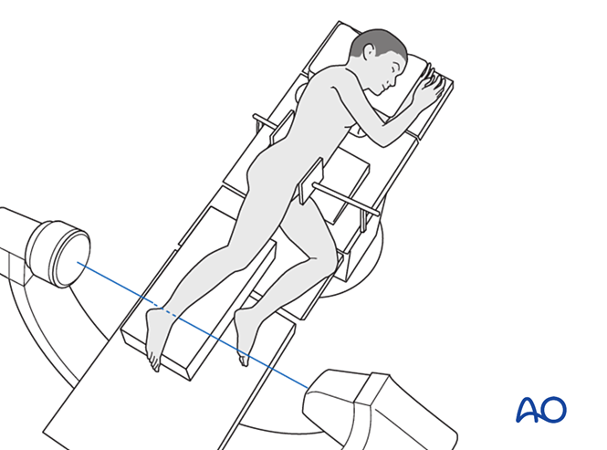 Patient Preparation In Lateral Decubitus Position 