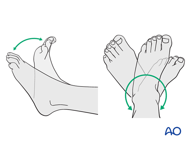 Range-of-motion exercises of the ankle