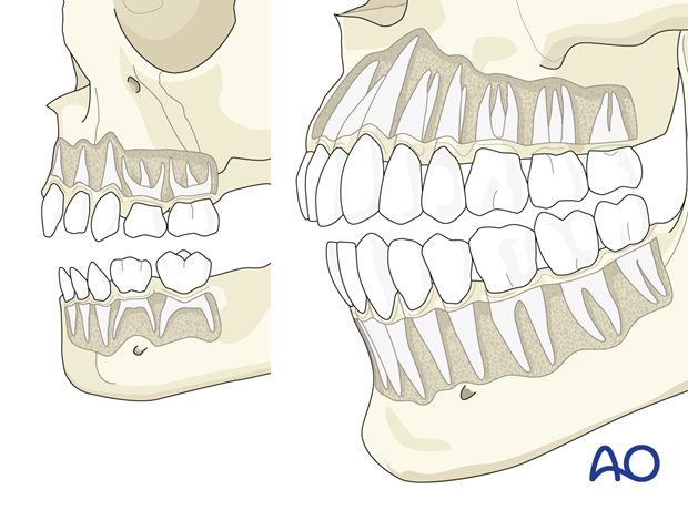 Lateral views of pediatric and adult skull showing differences in dentition.
