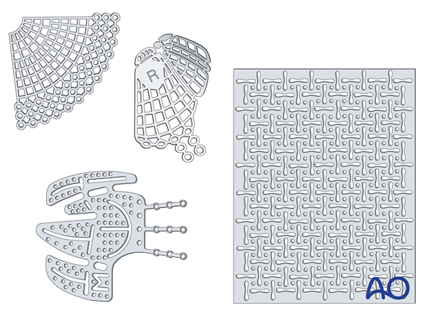 Various titanium meshes for orbital reconstruction