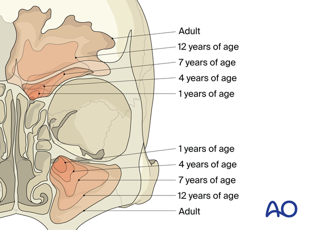 Development of the frontal and maxillary sinuses from childhood to adulthood.