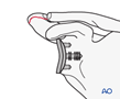 Avulsion of the acromion