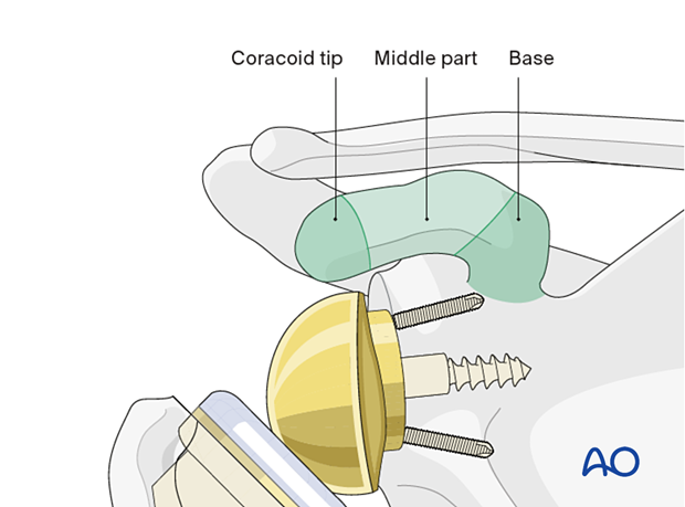 The coracoid