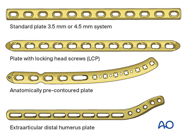 Plate types