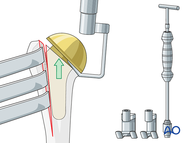 Tool used for implant extraction