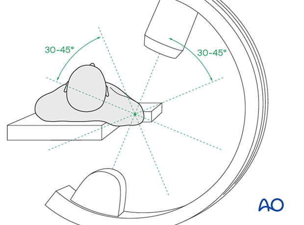 C-arm positioning