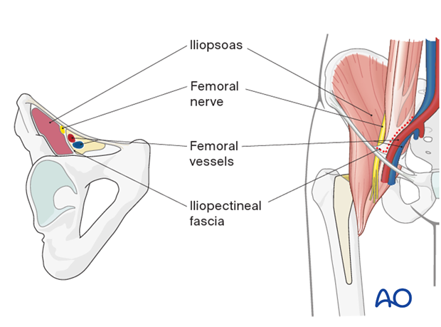 Anatomy of the femoral canal and iliopectineal fascia