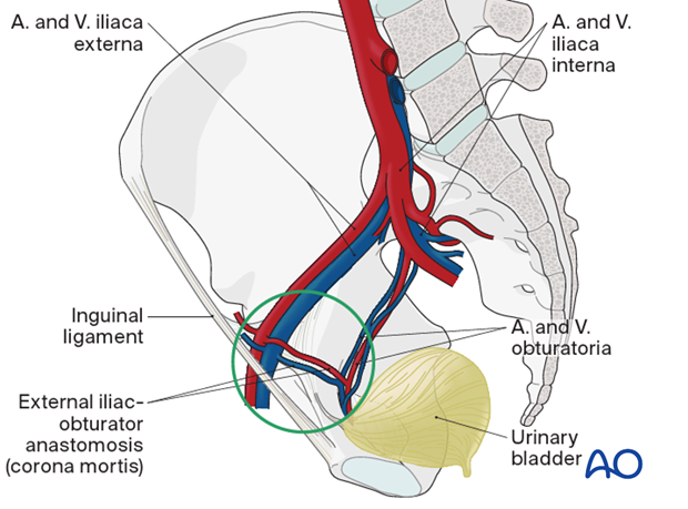 Retropubic vascular anastomoses