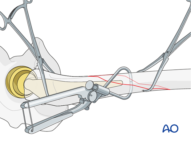 Handle components alignment