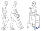 Protected weight bearing using assistive devices
