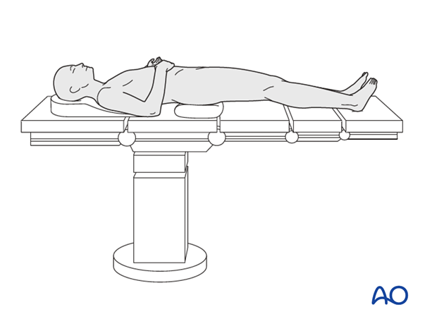 OR setup for supine patient positioning