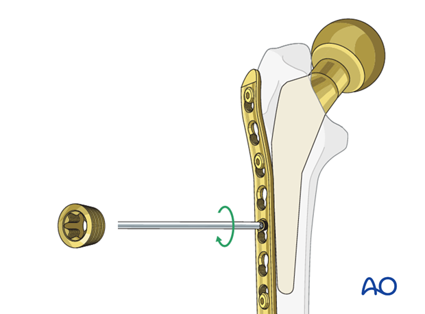 Screw the conical part to the plate