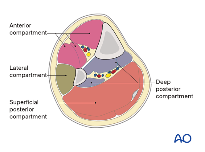 MIO Anterolateral approach to the proximal tibia