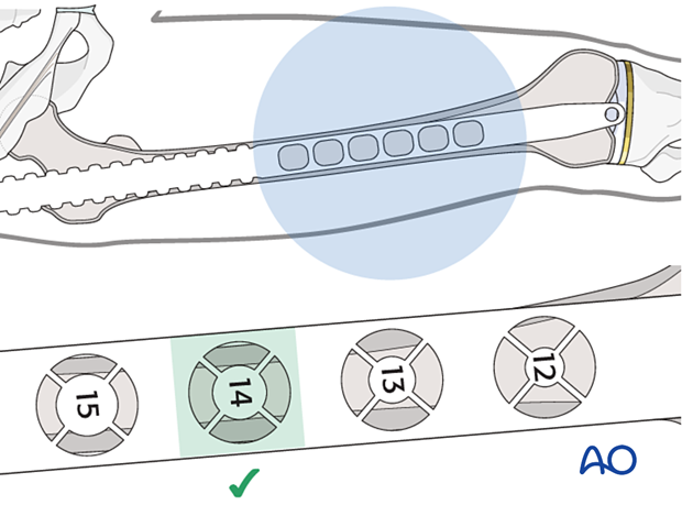 Nail diameter