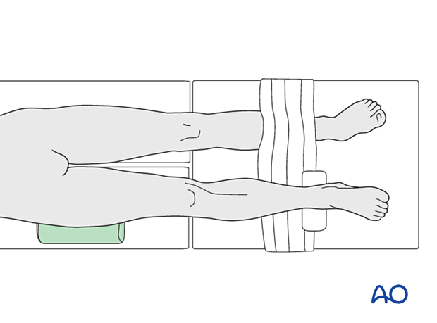 Supine positioning