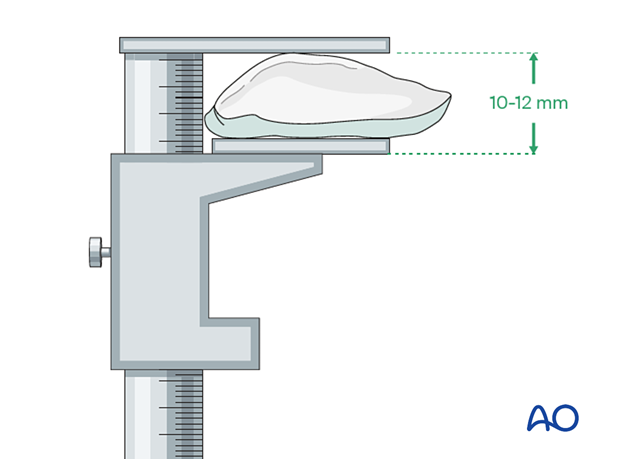 P420 Patella component revision with or without ORIF