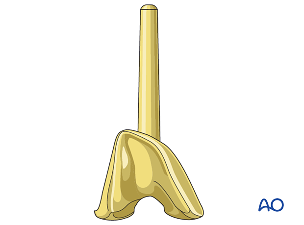 Femoral component