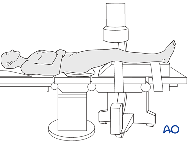 Supine position with C-arm