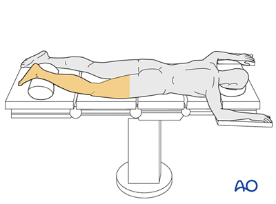 Prone position