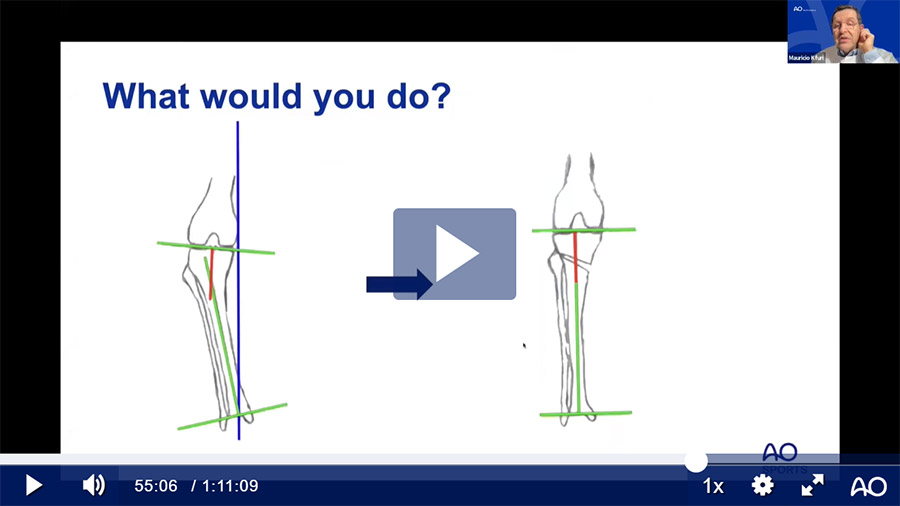 Video Medial knee