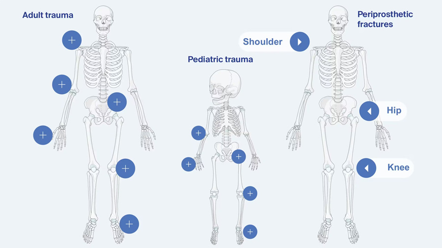 AO Surgery Reference Trauma section