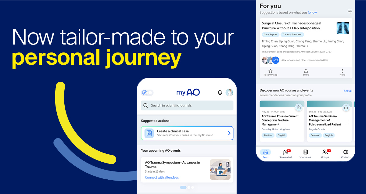 Latest myAO app update is fully tailored to user’s own journey