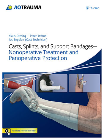 Care of Casts and Splints - OrthoInfo - AAOS