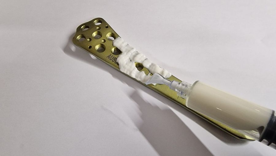 A hydrogel to prevent fracture-related infection