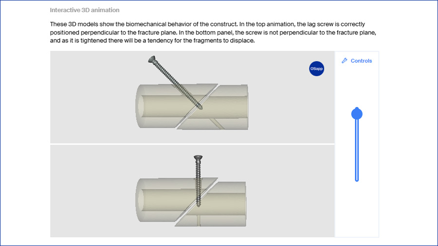 AO Surgery Reference, the digital knowledge hub for AO education, is enhanced by integration with OSapp