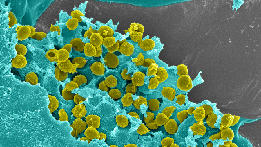ARI leads research into fracture-related infection