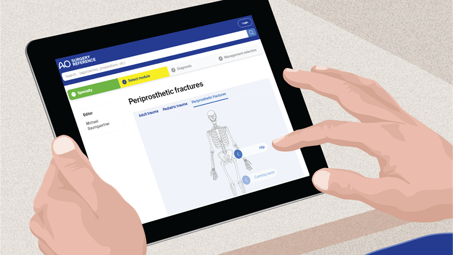 AO Surgery Reference periprosthetic hip fractures