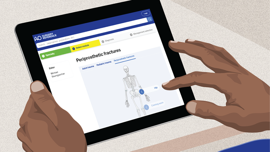 AO Surgery Reference periprosthetic hip fractures
