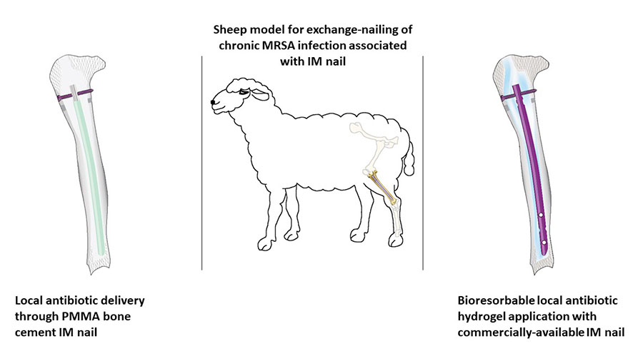 Newly published papers demonstrate success of ARI’s local antibiotic therapy