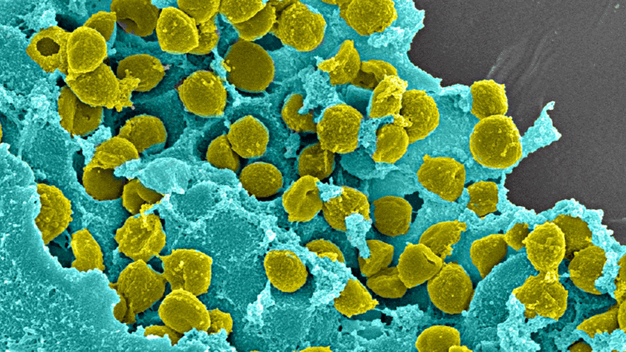 Building global consensus around fracture-related infections: ARI researchers publish paper in 'Nature Reviews Disease Primers'