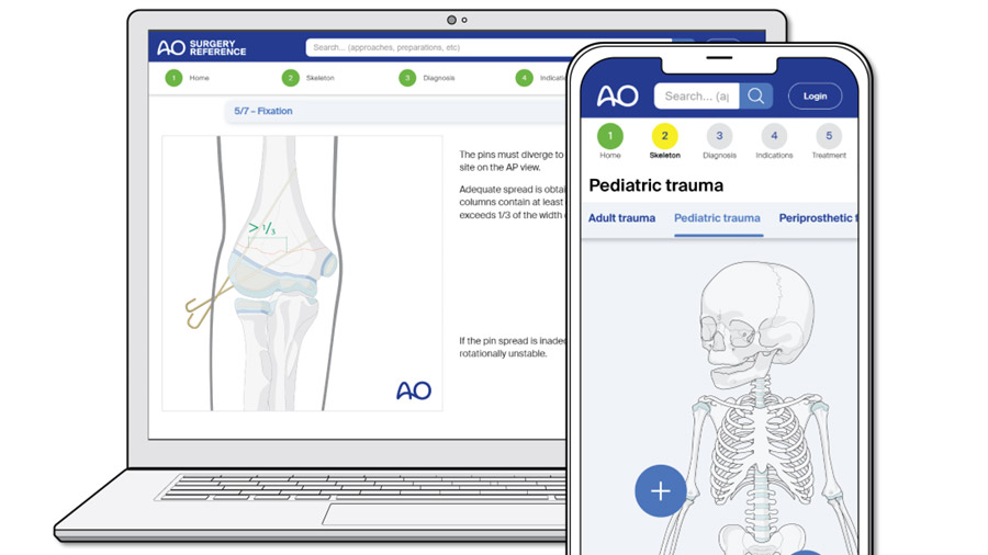 Meet the AO Surgery Reference editors: Fergal Monsell describes a unique tool for pediatric trauma management