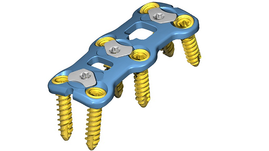 CODA Anterior Cervical Plate System