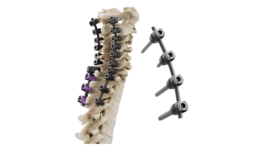 CMORE® Cervicothoracic System 