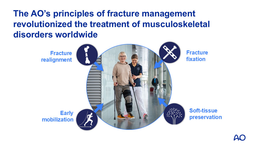 The AO’s 4 principles of fracture management