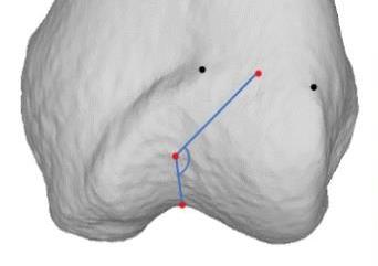Figure 2 EPTP Measuring Tool