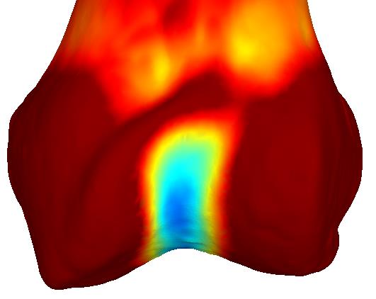 Figure 4. Curvature Maps - (B) AP-view highlighting structures with low curvature (i.e., trochlea groove).