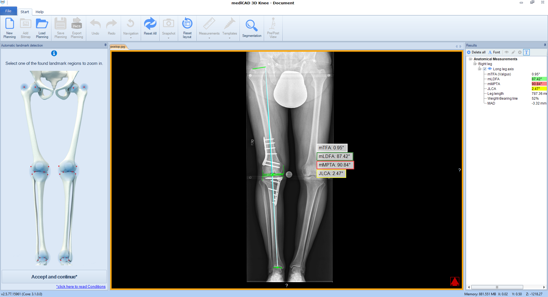 case 3 post analysis