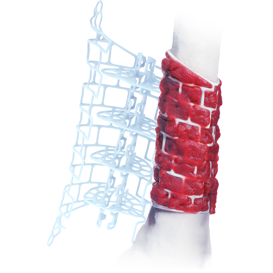Long Bone Graft Cage
