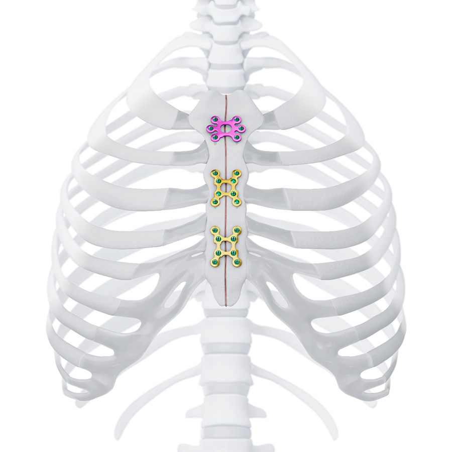 Image of MatrixSTERNUM