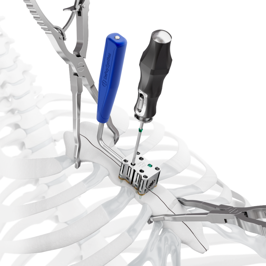 Image of Matrix STERNUM instrumentation